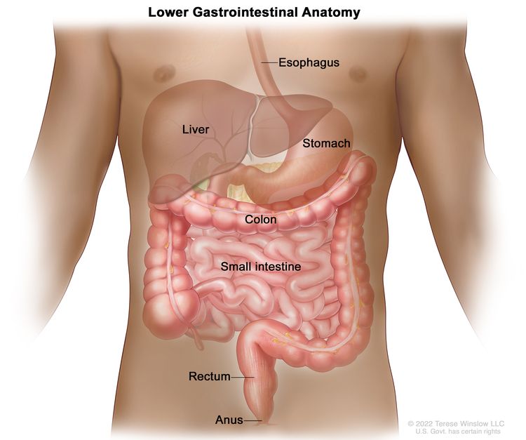 Colon Cancer